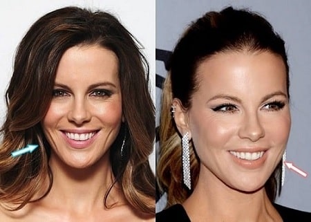 A before and after picture of Kate Beckinsale.